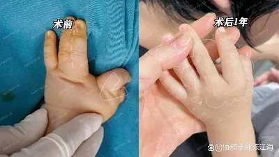 info-1242-699 info-1242-699