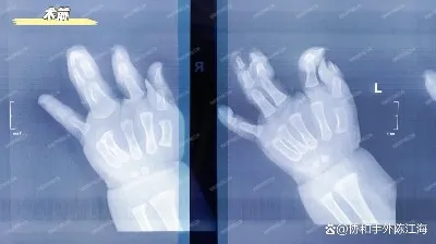 info-1242-698 info-1242-698