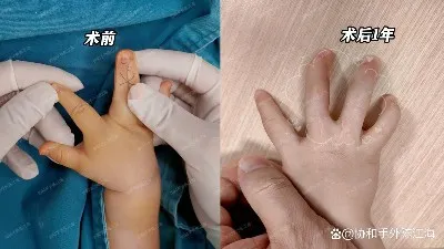 info-1242-699 info-1242-699